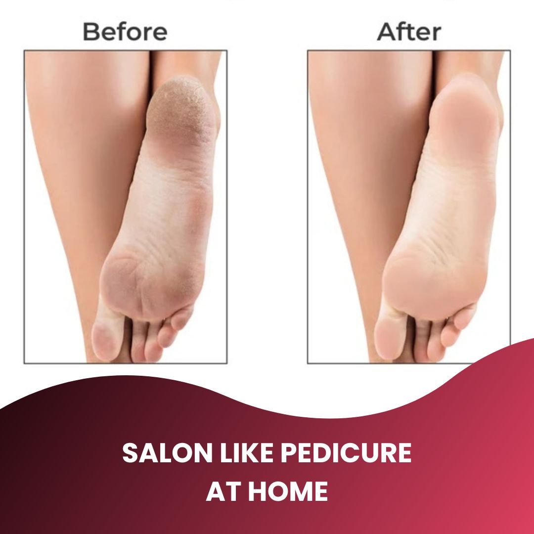 Portable Pedicure Electric Callus Remover